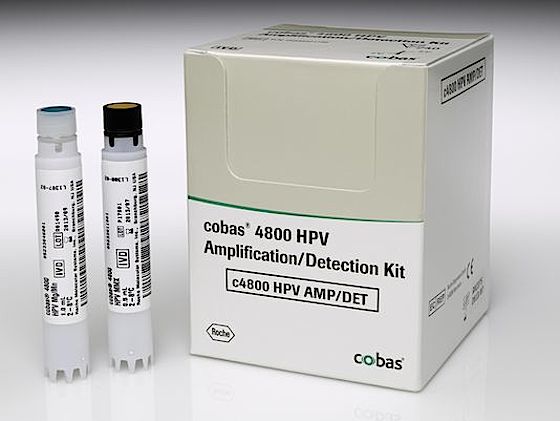 1398442512000--roche-s-cobas-hpv-test