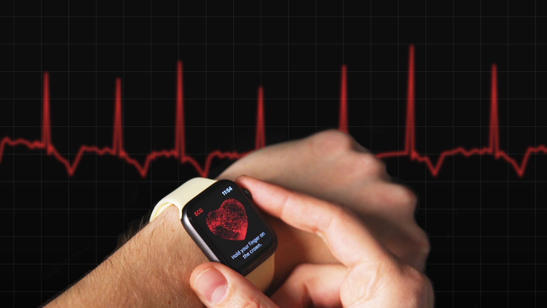 Why doctors are worried about the Apple Watch EKG - The Verge